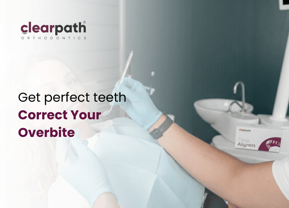 Clear Aligners for Overbite